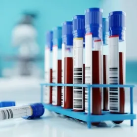 Exames Complementares